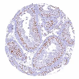 Anti-CBP antibody [HMV319] HistoMAX&trade; used in IHC (Paraffin sections) (IHC-P). GTX639943