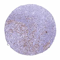 Anti-TIGIT antibody [HMV322] HistoMAX&trade; used in IHC (Paraffin sections) (IHC-P). GTX639946