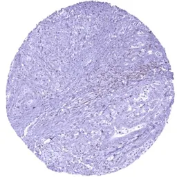 Anti-TIGIT antibody [HMV322] HistoMAX&trade; used in IHC (Paraffin sections) (IHC-P). GTX639946