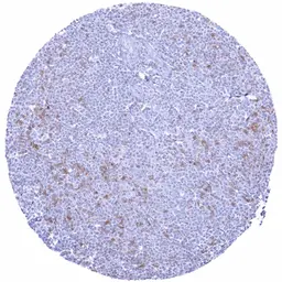 Anti-TIGIT antibody [HMV323] HistoMAX&trade; used in IHC (Paraffin sections) (IHC-P). GTX639947