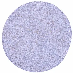 Anti-TIGIT antibody [HMV323] HistoMAX&trade; used in IHC (Paraffin sections) (IHC-P). GTX639947