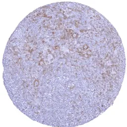 Anti-TIGIT antibody [HMV323] HistoMAX&trade; used in IHC (Paraffin sections) (IHC-P). GTX639947