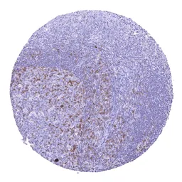 Anti-TIGIT antibody [HMV323] HistoMAX&trade; used in IHC (Paraffin sections) (IHC-P). GTX639947