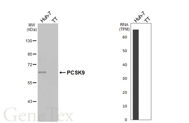 Anti-PCSK9 antibody [HL2814] used in Western Blot (WB). GTX639955
