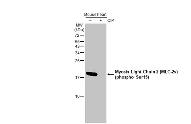 Anti-Myosin Light Chain 2 (MLC-2v) (phospho Ser15) antibody [HL2891] used in Western Blot (WB). GTX640170