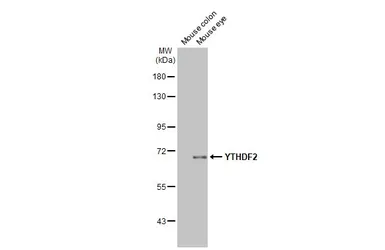 Anti-YTHDF2 antibody [HL2910] used in Western Blot (WB). GTX640253