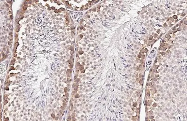Anti-YTHDF2 antibody [HL2910] used in IHC (Paraffin sections) (IHC-P). GTX640253