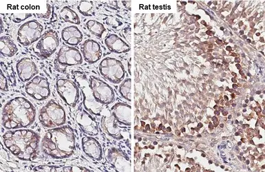 Anti-YTHDF2 antibody [HL2910] used in IHC (Paraffin sections) (IHC-P). GTX640253