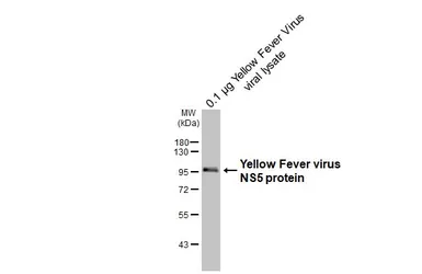 Anti-Yellow Fever virus NS5 protein antibody [HL2916] used in Western Blot (WB). GTX640259