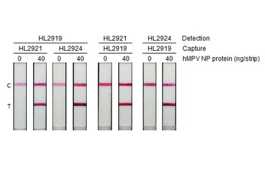 Anti-Human metapneumovirus Nucleoprotein antibody [HL2919] used in Lateral Flow (Lateral Flow). GTX640262