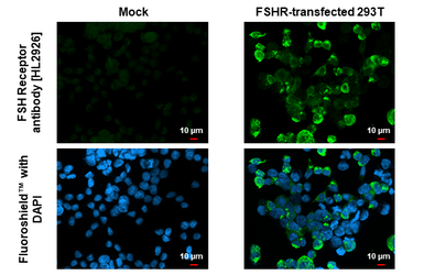 Anti-FSH Receptor antibody [HL2926] used in Immunocytochemistry/ Immunofluorescence (ICC/IF). GTX640269