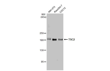 Anti-TSC2 antibody [HL2974] used in Western Blot (WB). GTX640361