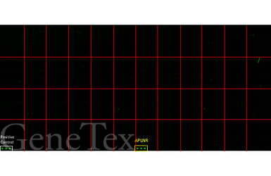 Anti-Apelin Receptor antibody [HL2980] used in Functional Assay (Functional Assay). GTX640367