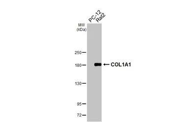 Anti-COL1A1 antibody [HL3040] used in Western Blot (WB). GTX640483
