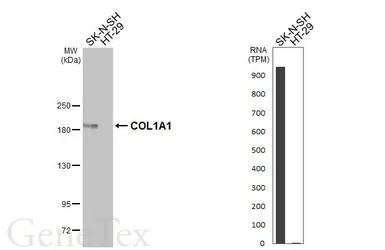 Anti-COL1A1 antibody [HL3040] used in Western Blot (WB). GTX640483