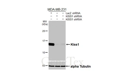 Anti-Kiss1 antibody [HL3043] used in Western Blot (WB). GTX640486