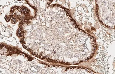 Anti-Kiss1 antibody [HL3043] used in IHC (Paraffin sections) (IHC-P). GTX640486