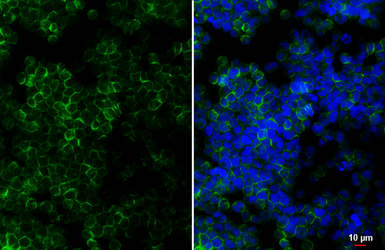 Anti-CCR9 antibody [HL3054] used in Immunocytochemistry/ Immunofluorescence (ICC/IF). GTX640497