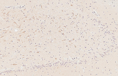 Anti-Dopamine Receptor D5 antibody [HL3100] used in IHC (Paraffin sections) (IHC-P). GTX640546