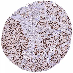 Anti-53BP1 antibody [HMV324] HistoMAX&trade; used in IHC (Paraffin sections) (IHC-P). GTX640556