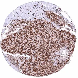 Anti-53BP1 antibody [HMV324] HistoMAX&trade; used in IHC (Paraffin sections) (IHC-P). GTX640556