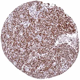 Anti-53BP1 antibody [HMV324] HistoMAX&trade; used in IHC (Paraffin sections) (IHC-P). GTX640556