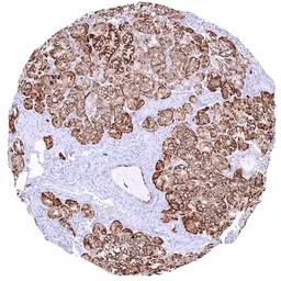 Anti-Anterior Gradient 2 antibody [HMV325] HistoMAX&trade; used in IHC (Paraffin sections) (IHC-P). GTX640557