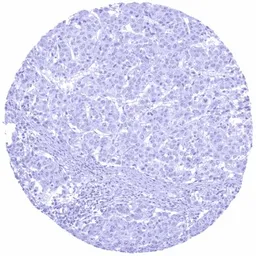 Anti-Anterior Gradient 2 antibody [HMV325] HistoMAX&trade; used in IHC (Paraffin sections) (IHC-P). GTX640557