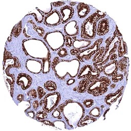 Anti-Anterior Gradient 2 antibody [HMV325] HistoMAX&trade; used in IHC (Paraffin sections) (IHC-P). GTX640557