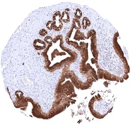 Anti-Anterior Gradient 2 antibody [HMV325] HistoMAX&trade; used in IHC (Paraffin sections) (IHC-P). GTX640557