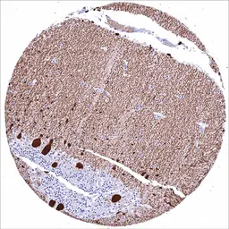 Anti-Calbindin antibody [HMV326] HistoMAX&trade; used in IHC (Paraffin sections) (IHC-P). GTX640558