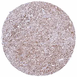 Anti-Calbindin antibody [HMV326] HistoMAX&trade; used in IHC (Paraffin sections) (IHC-P). GTX640558