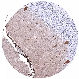 Anti-Calbindin antibody [HMV326] HistoMAX&trade; used in IHC (Paraffin sections) (IHC-P). GTX640558