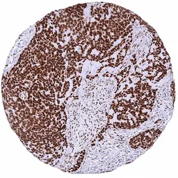 Anti-NFIX antibody [HMV329] HistoMAX&trade; used in IHC (Paraffin sections) (IHC-P). GTX640561