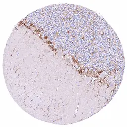 Anti-PSAT1 antibody [HMV331] HistoMAX&trade; used in IHC (Paraffin sections) (IHC-P). GTX640563