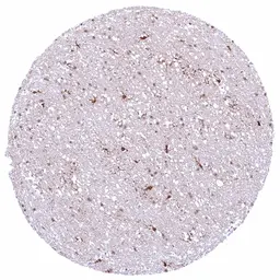Anti-PSAT1 antibody [HMV331] HistoMAX&trade; used in IHC (Paraffin sections) (IHC-P). GTX640563