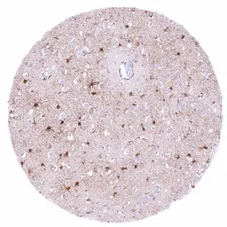 Anti-PSAT1 antibody [HMV331] HistoMAX&trade; used in IHC (Paraffin sections) (IHC-P). GTX640563