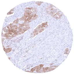 Anti-PSAT1 antibody [HMV331] HistoMAX&trade; used in IHC (Paraffin sections) (IHC-P). GTX640563