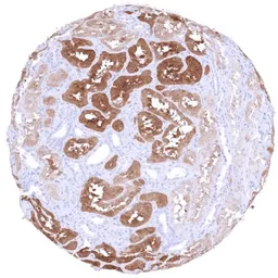 Anti-PSAT1 antibody [HMV331] HistoMAX&trade; used in IHC (Paraffin sections) (IHC-P). GTX640563