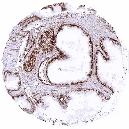 Anti-Vimentin antibody [HMV332] HistoMAX&trade; used in IHC (Paraffin sections) (IHC-P). GTX640564