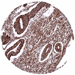 Anti-Vimentin antibody [HMV332] HistoMAX&trade; used in IHC (Paraffin sections) (IHC-P). GTX640564