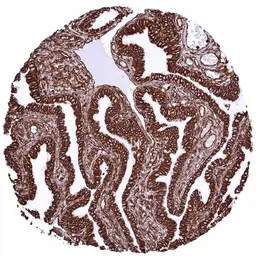 Anti-Vimentin antibody [HMV332] HistoMAX&trade; used in IHC (Paraffin sections) (IHC-P). GTX640564