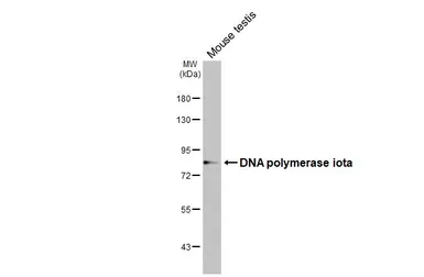 Anti-DNA polymerase iota antibody [HL3115] used in Western Blot (WB). GTX640591