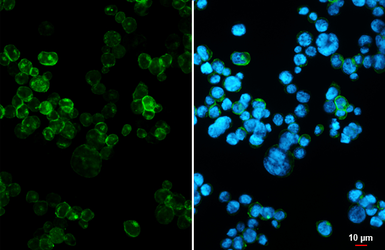 Anti-Cannabinoid receptor 2 antibody [HL3120] used in Immunocytochemistry/ Immunofluorescence (ICC/IF). GTX640596