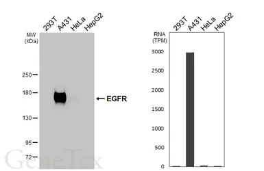 Anti-EGFR antibody [HL3153] used in Western Blot (WB). GTX640663