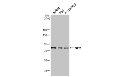 Anti-SP2 antibody [HL3155] used in Western Blot (WB). GTX640665