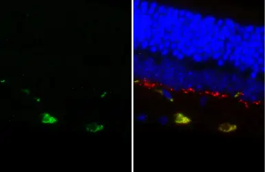 Anti-Dopamine Receptor D2 antibody [HL3159] used in IHC (Paraffin sections) (IHC-P). GTX640669