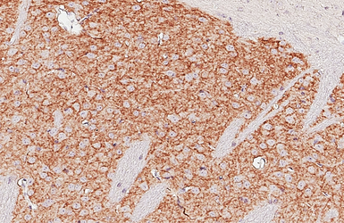 Anti-Dopamine Receptor D2 antibody [HL3159] used in IHC (Paraffin sections) (IHC-P). GTX640669