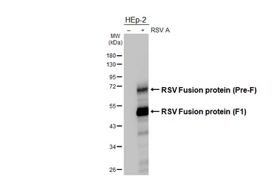 Anti-Respiratory Syncytial virus Fusion protein antibody [GT14] used in Western Blot (WB). GTX640819