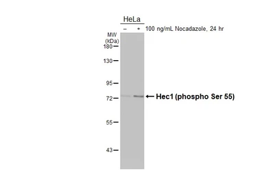 Anti-Hec1 (phospho Ser 55) antibody [HL3190] used in Western Blot (WB). GTX640829